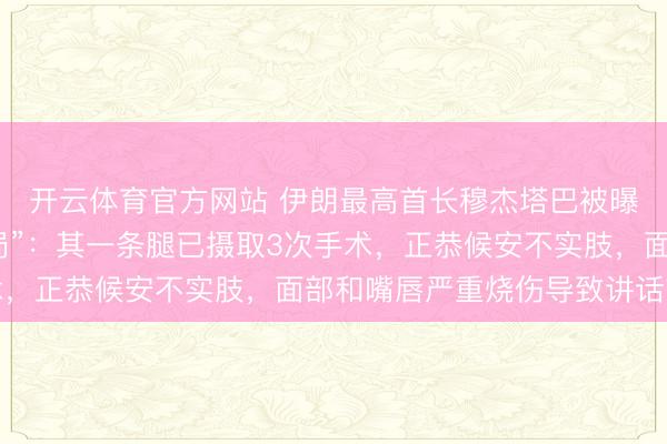 开云体育官方网站 伊朗最高首长穆杰塔巴被曝“身负重伤，仍控全局”：其一条腿已摄取3次手术，正恭候安不实肢，面部和嘴唇严重烧伤导致讲话贫窭